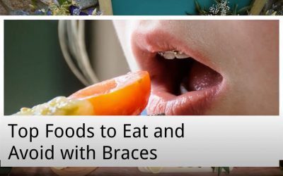 Top Foods to Eat and Avoid with Braces from Port Macquarie Dental Centre