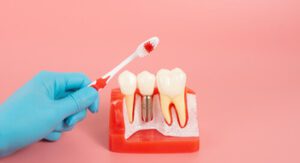 cost of dental implants in Australia procedures