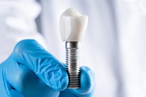 bali dental implant types